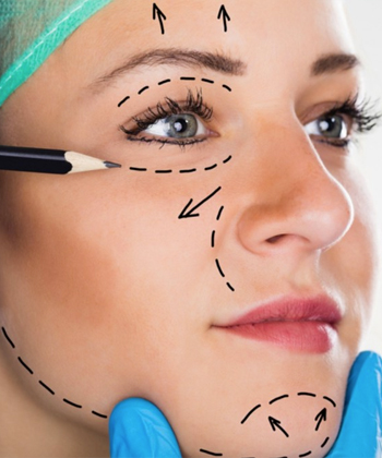 Facelift (cirurgia de rugas)